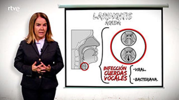  - Recomendaciones para cuando estás afónico