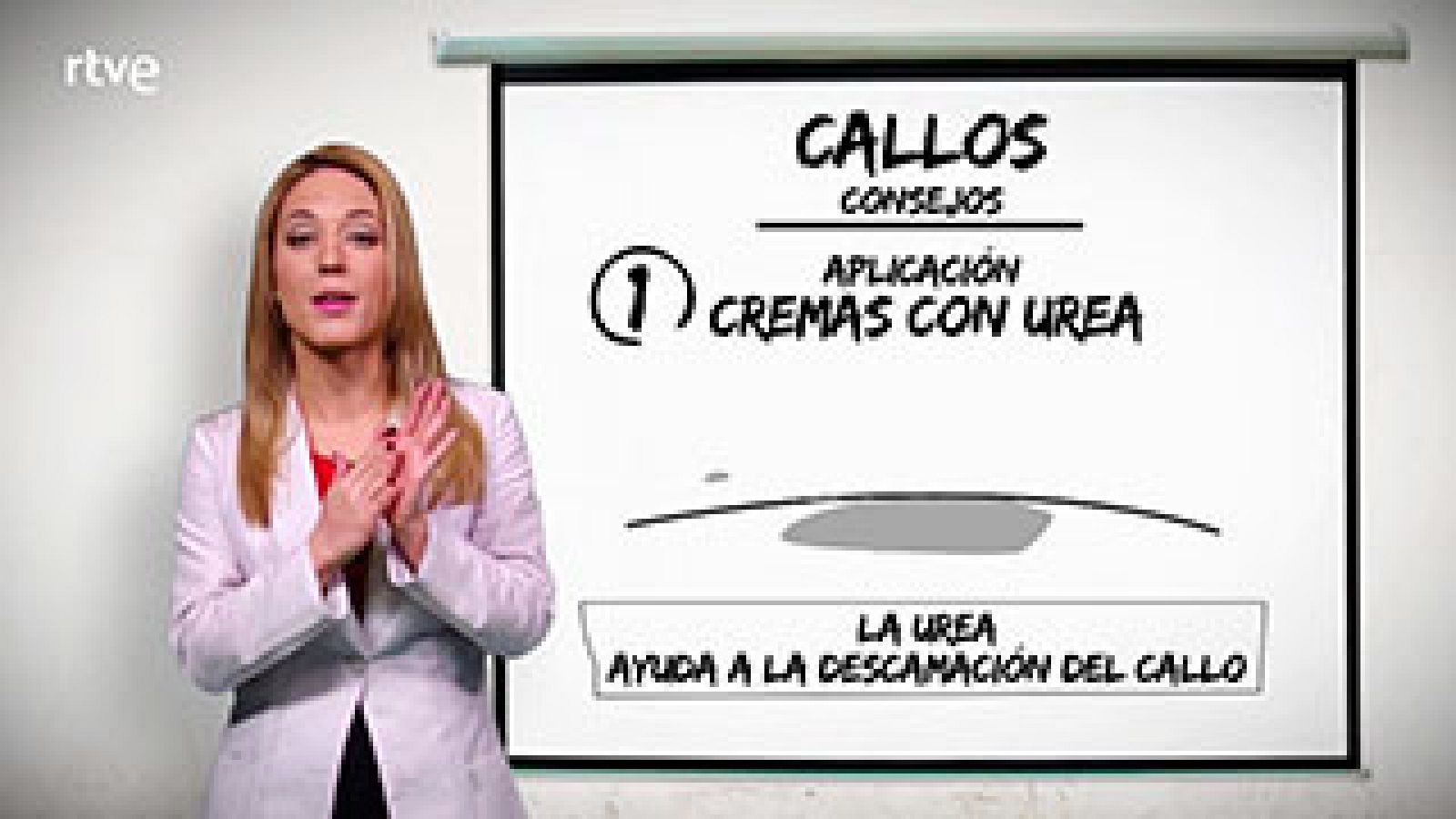  Si estás cansado de tener callos, te explicamos cómo eliminarlos