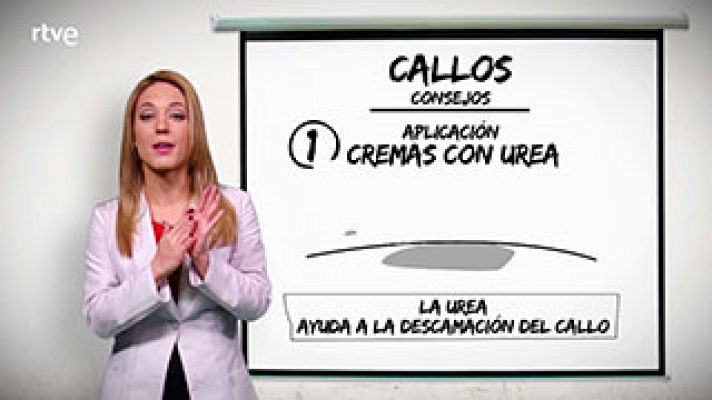  - Si estás cansado de tener callos. 3 pasos para eliminarlos