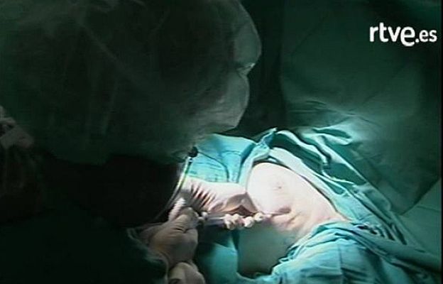 Ciencia y tecnología en Rtve.es - Reconstruir el pecho con células