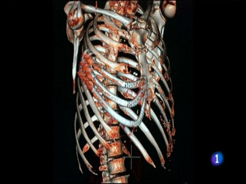 Asturias en 2' - 19/02/16 | Ver