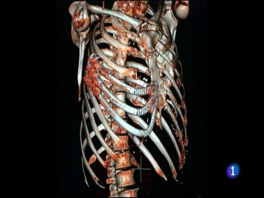 Panorama Regional - Panorama Regional - 19/02/16