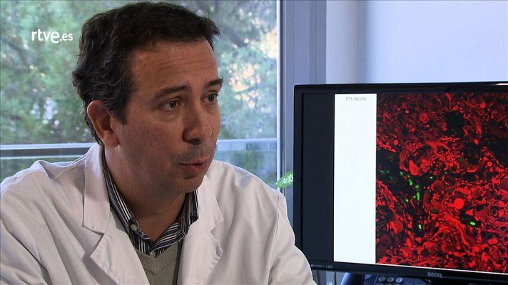 Tinc una idea - Dr. Joan Seoane, una vida dedicada a combatre el càncer