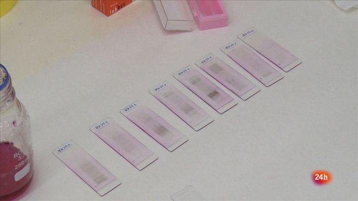 Repor - Reaccionar a la alergia