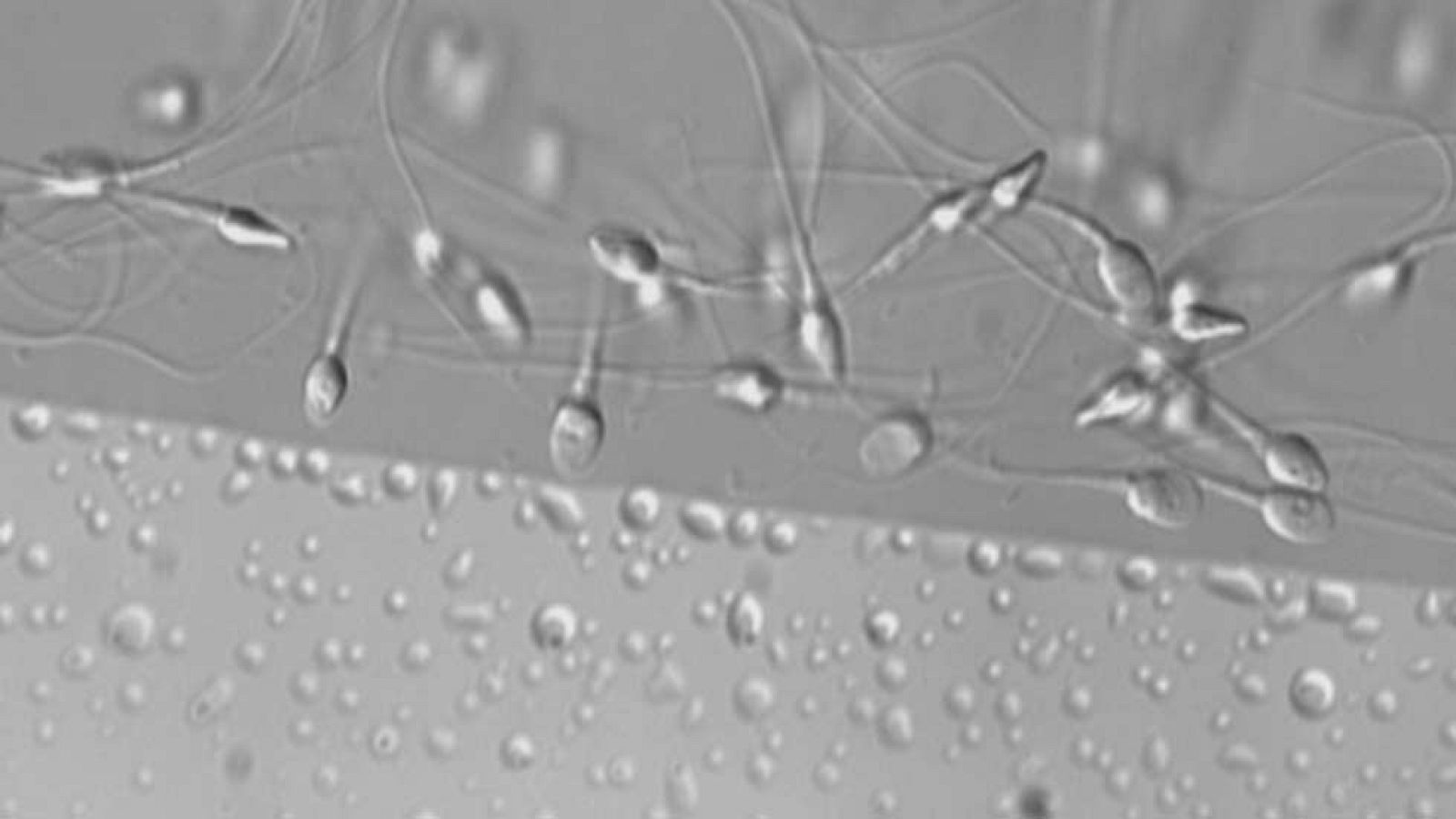 Tres de cada diez hombres en edad fértil tiene semen de mala calidad