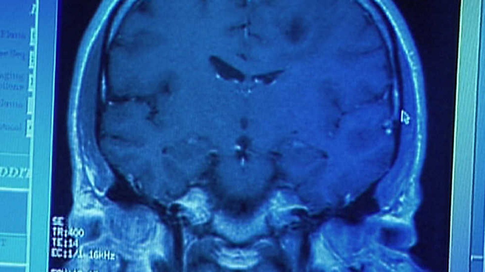 La noche temática - La ciencia del mal - ver ahora