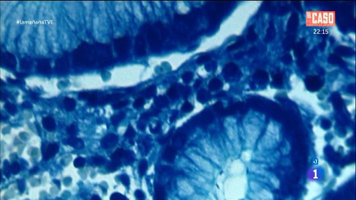 La mañana - Problemas de estómago