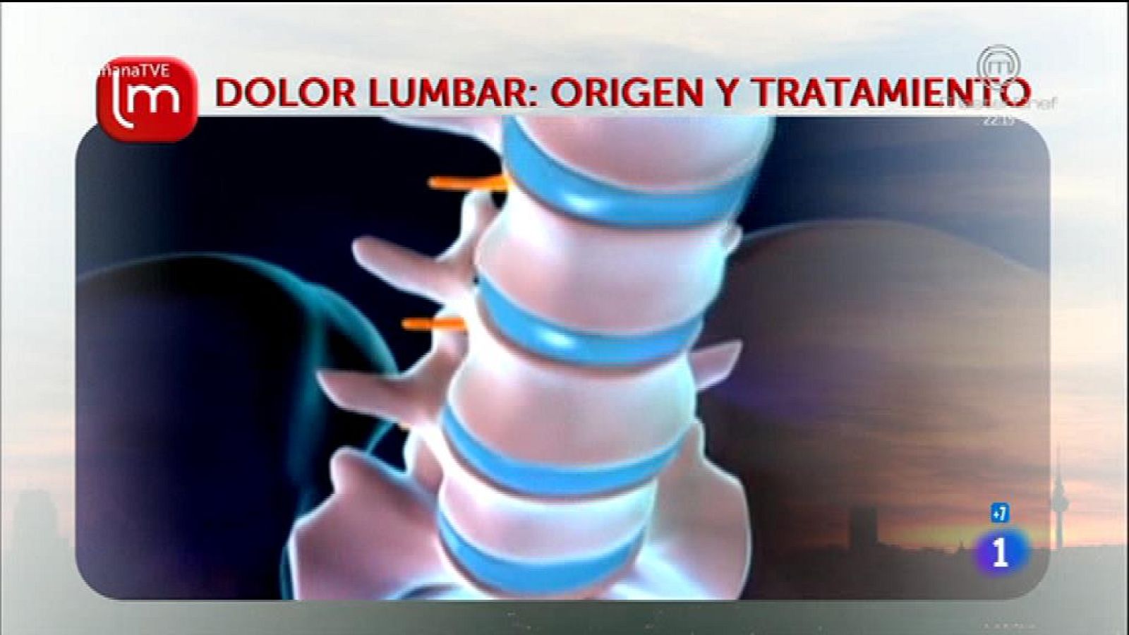 Dolor lumbar