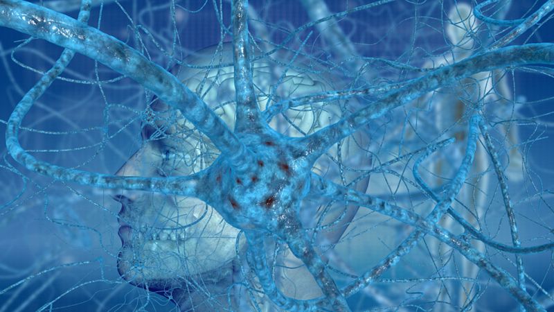 Científicos localizan la región del cerebro donde se origina el olvido