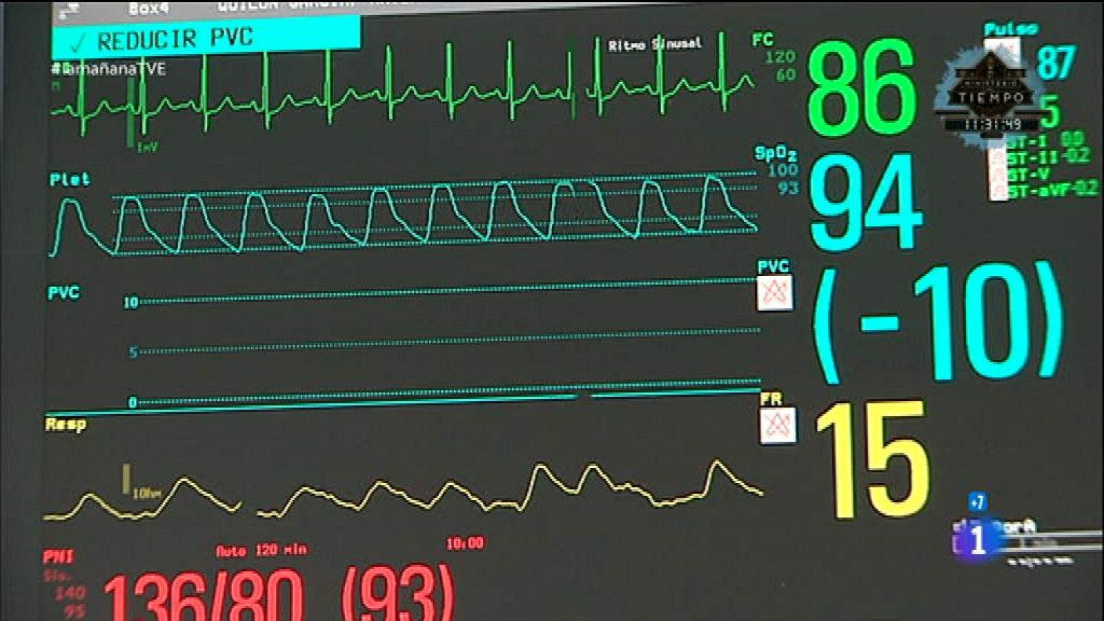 Disgustos y corazón