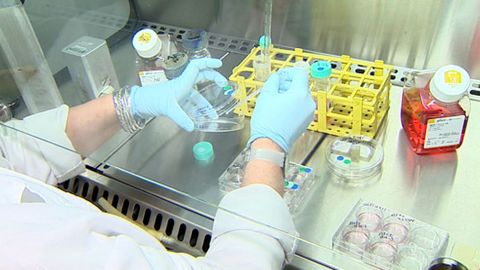 Se busca mejorar la efectividad de la quimioterapia contra el cáncer de mama, combinándola con análogos de vitamina D