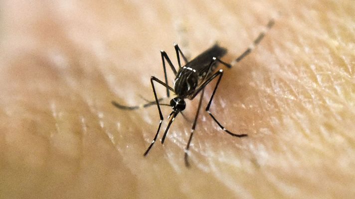  - Detectado el primer caso en España de un feto con microcefalia por el virus del Zika