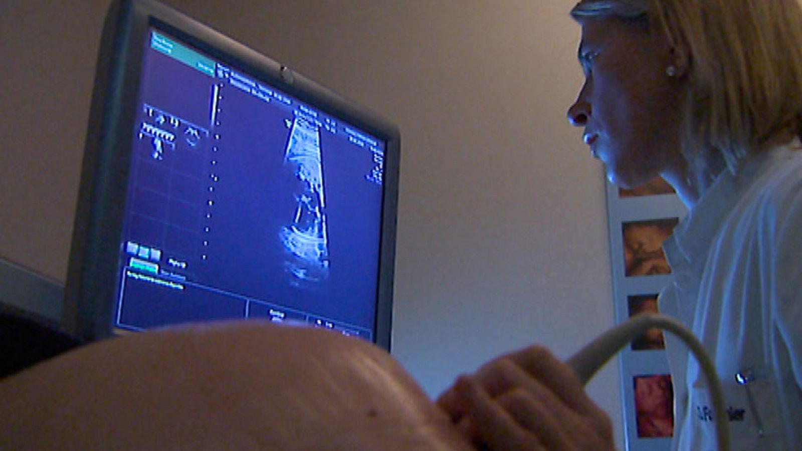 Los científicos aún no han podido precisar la relación causa-efecto entre el Zika y la microcefalia