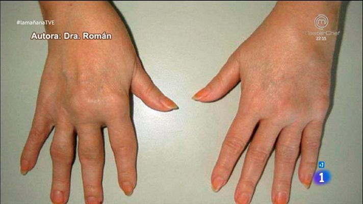 La mañana - Las partes blandas