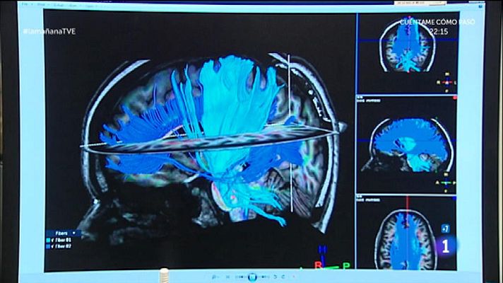 La mañana - Medicamentos y cerebro