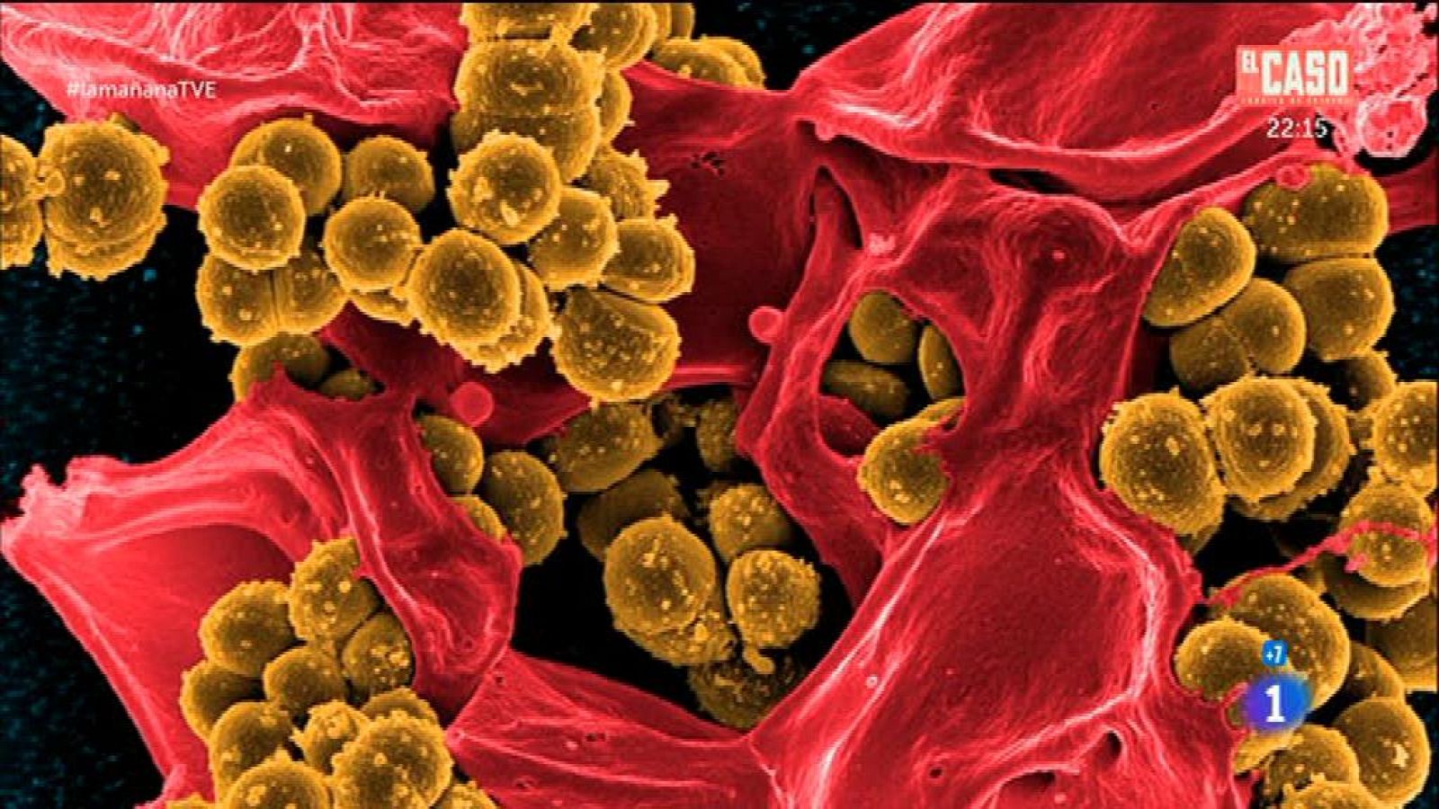 Medicación, dieta y flora