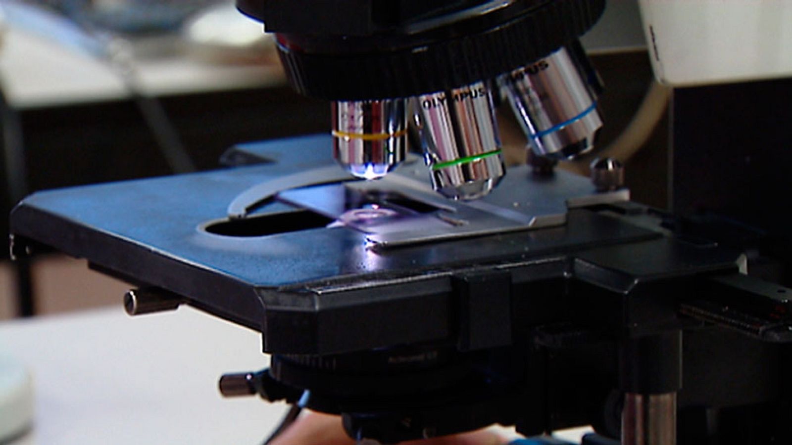 Científicos del CNIO investigan la identificación temprana de los tumores provocados por lunares de piel