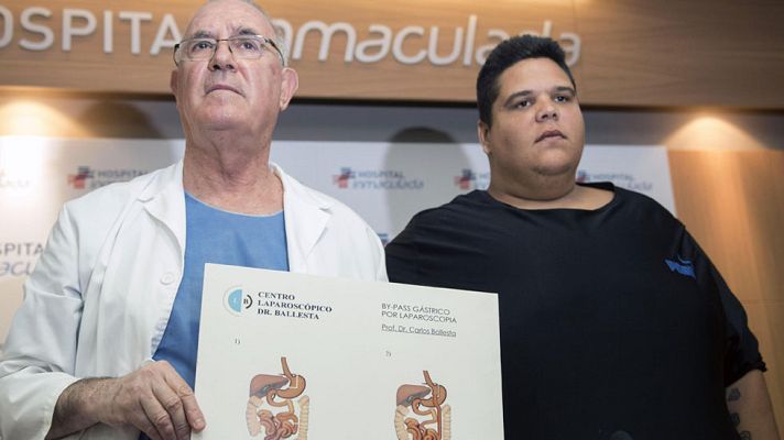 Telediario 1 - El hombre más obeso del país perderá 200 kilos tras ser operado con una novedosa técnica en Granada