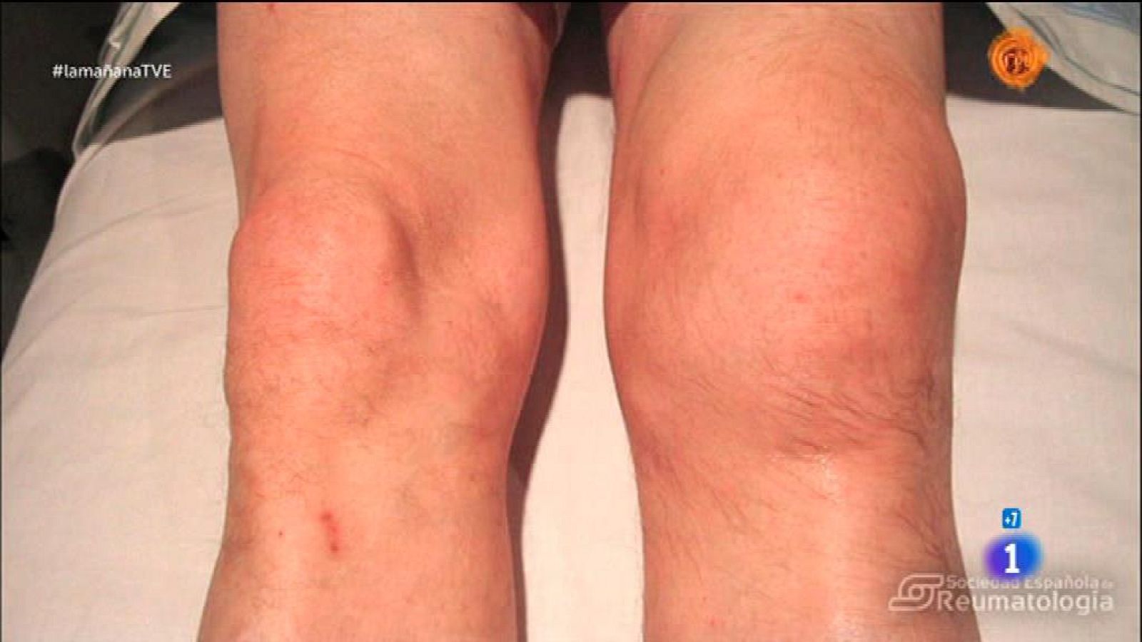 Movimiento de articulaciones