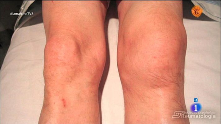 La mañana - Movimiento de articulaciones