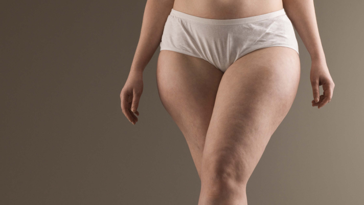 La mañana - La Celulitis