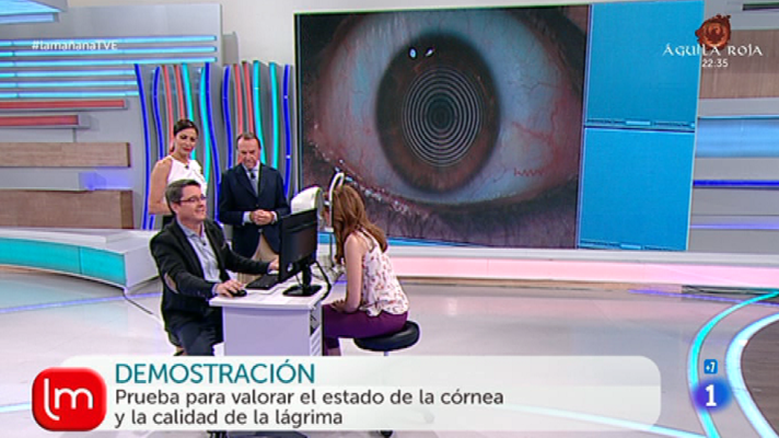 La mañana - Jota Abril y Ana Bellón se hacen la prueba de la cornea