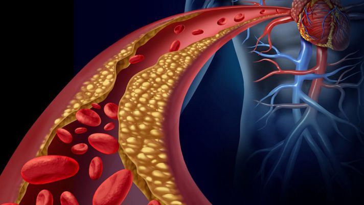 La mañana - Colesterol en verano