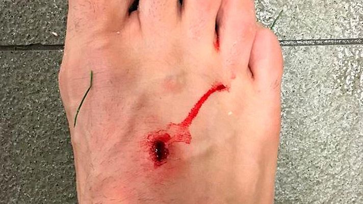 Telediario 1 - Filipe Luis se queja de la entrada de Luis Suárez: "Menos mal que no me toca"