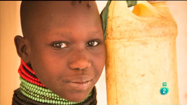 La aventura del Saber - Cirugía en Turkana