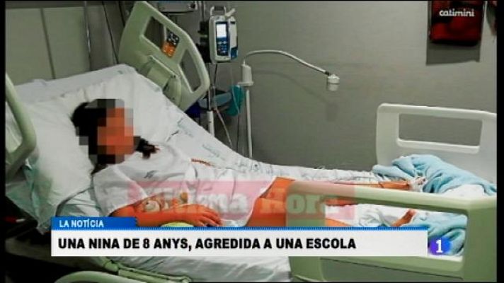 Informatiu Balear - Investiguen l'agressió d'una nina a l'escola