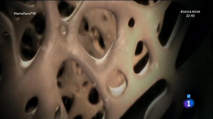 La mañana - Dia mundial de la osteoporosis