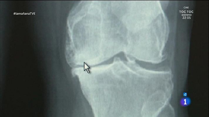 La mañana - Cuidado de las rodillas