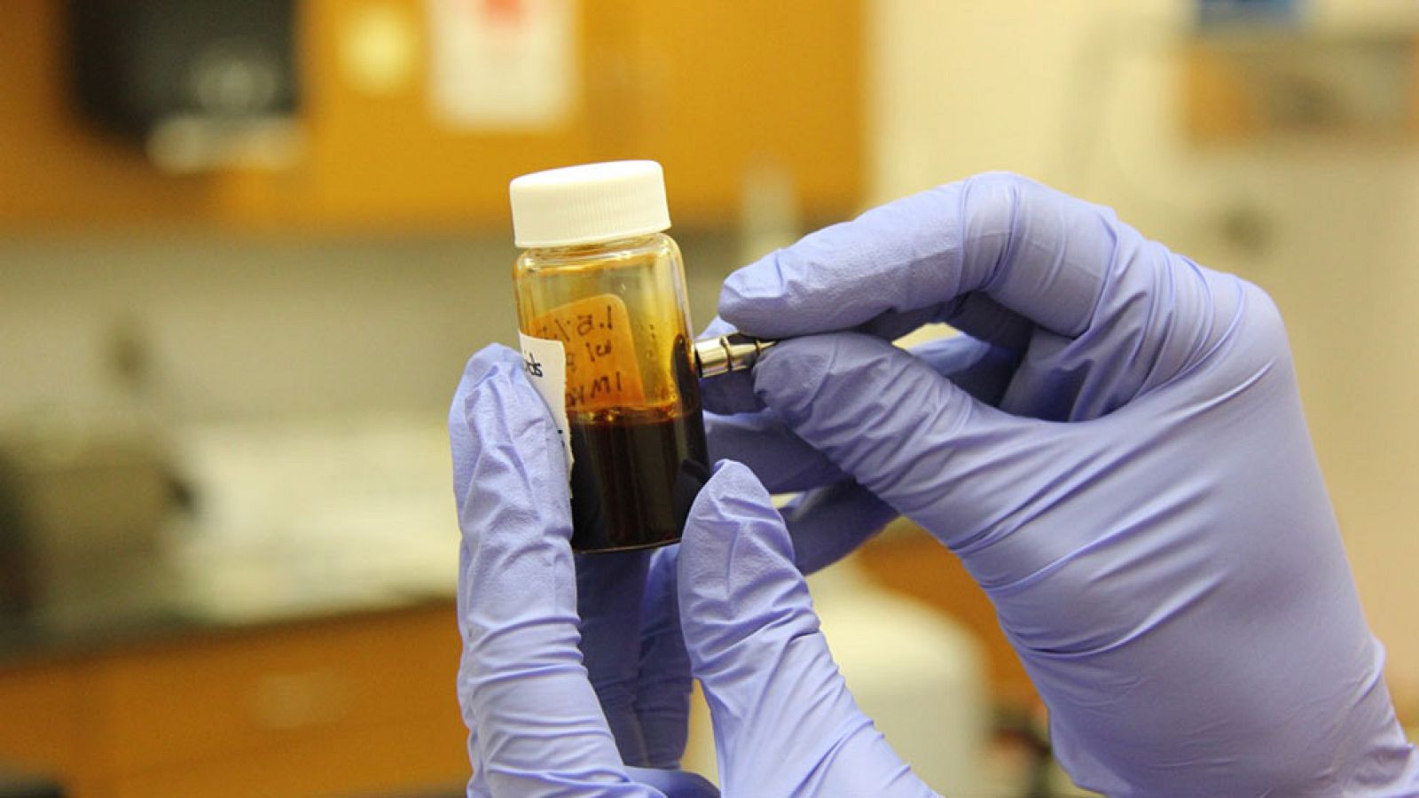 Nueva terapia para frenar la esclerosis múltiple con el uso de células sanguíneas del paciente