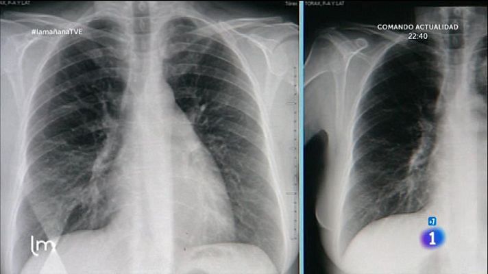 La mañana - Problemas respiratorios