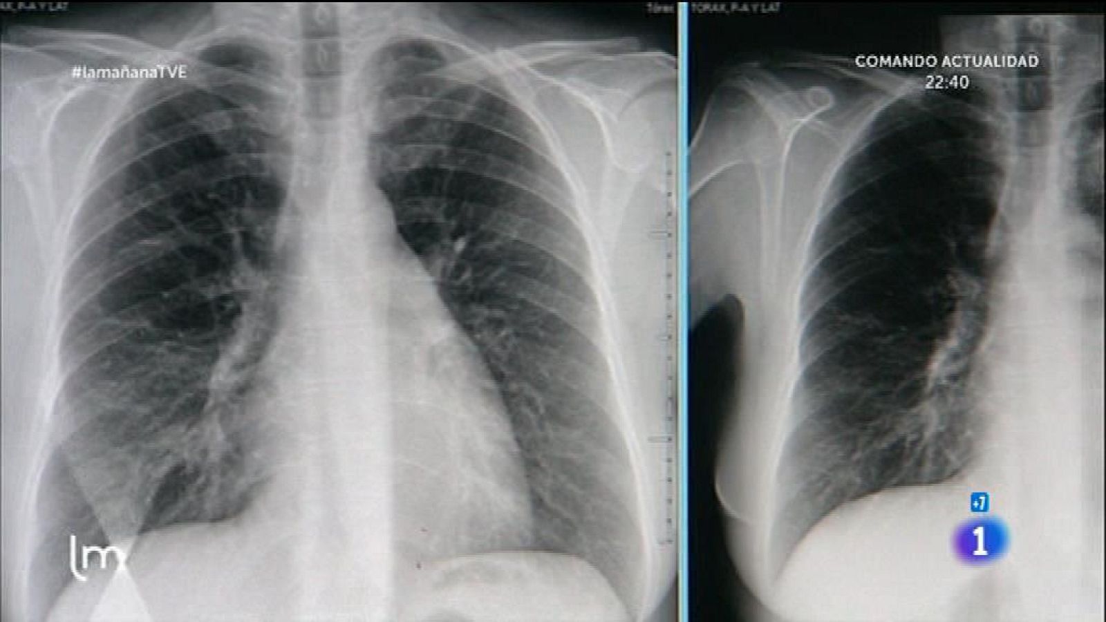 Problemas respiratorios