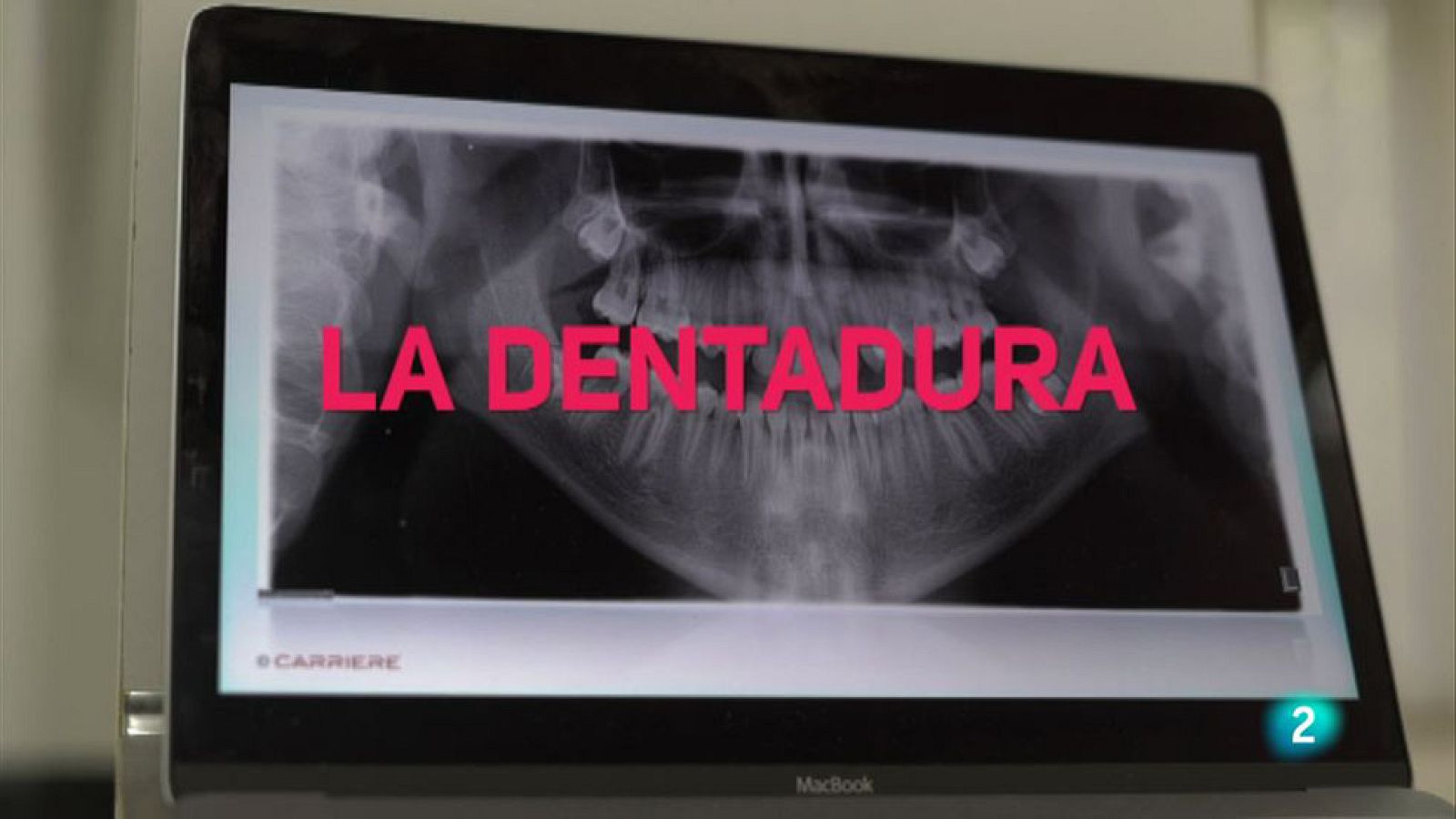 Amb identitat - Les dents