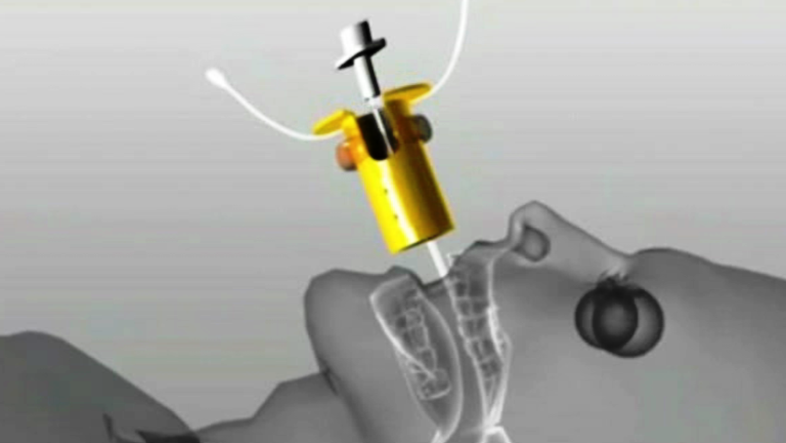 Fábrica de ideas - Inventa: CLIP-FAB | Ver