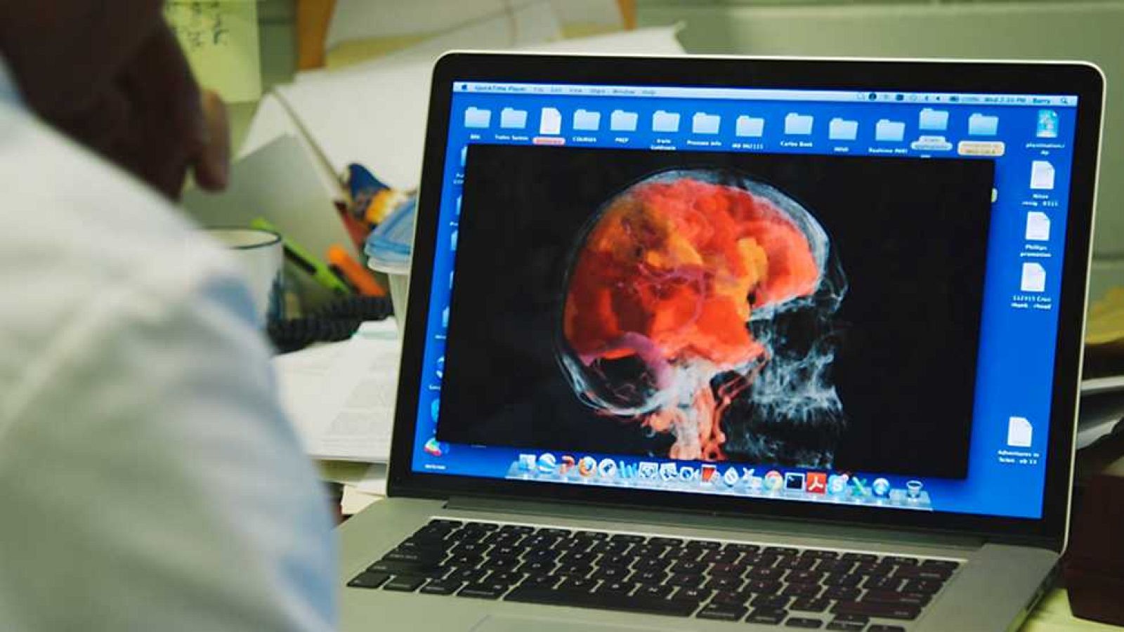 El cazador de cerebros - La ciencia del sexo - ver ahora