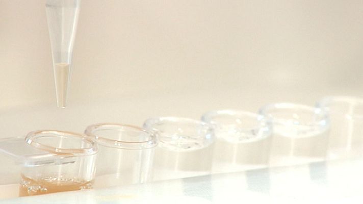 Telediario 1 - Un test genético permite predecir si la quimioterapia será efectiva