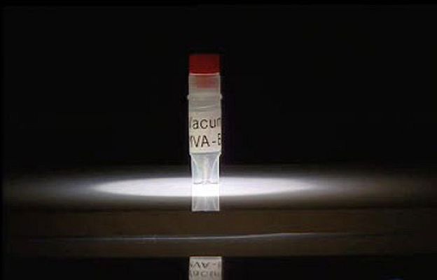 Ciencia y tecnología en Rtve.es - Ensayando la 1ª vacuna del sida