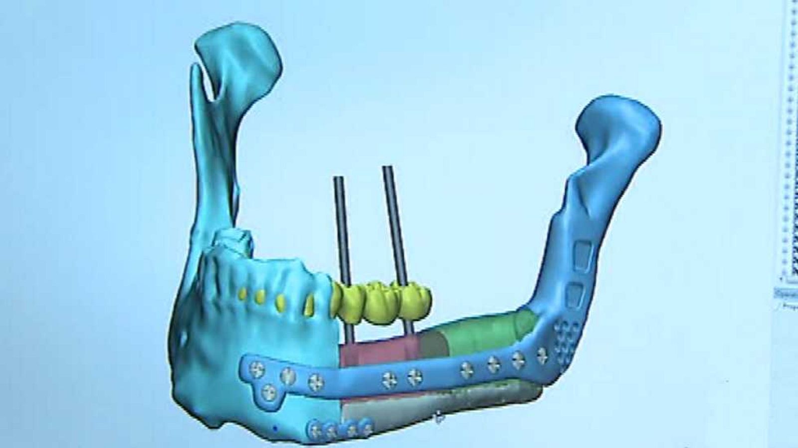 Emprende -  05/01/17 - ver ahora