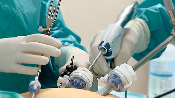 Telediario 1 - El equipo de TVE ha sido testigo de una cirugía laparoscopia