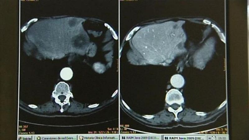 Canarias en 2' - 04/02/2017