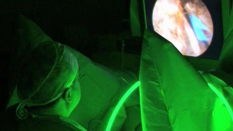 Telecanarias - 04/02/2017