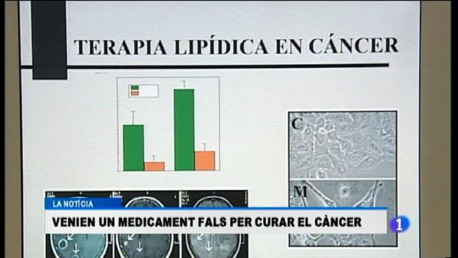 Informatiu Balear 2 - 11/04/17