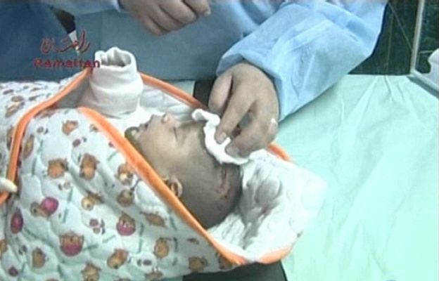  - Los niños, los más indefensos