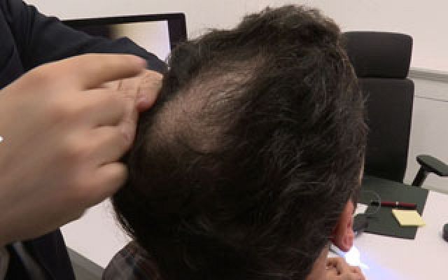 Repor - Menudo calvario - Avance