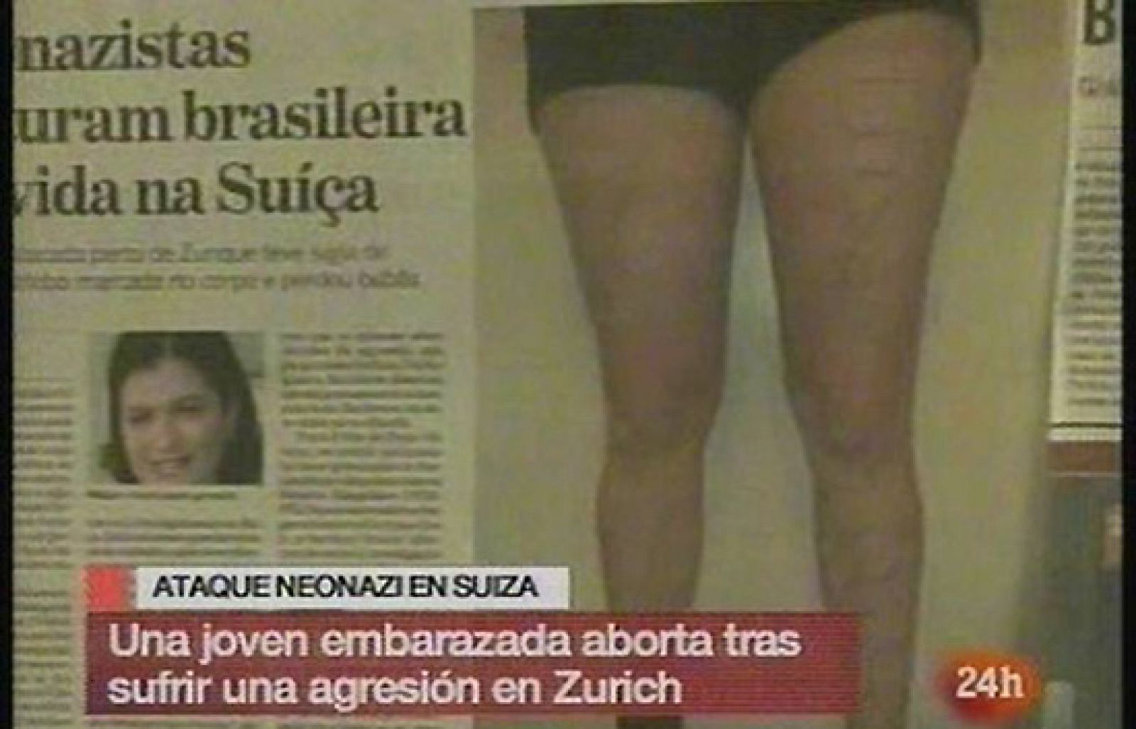 Ataque neonazi a una chica que pierde a sus gemelos tras la agresión | Ver