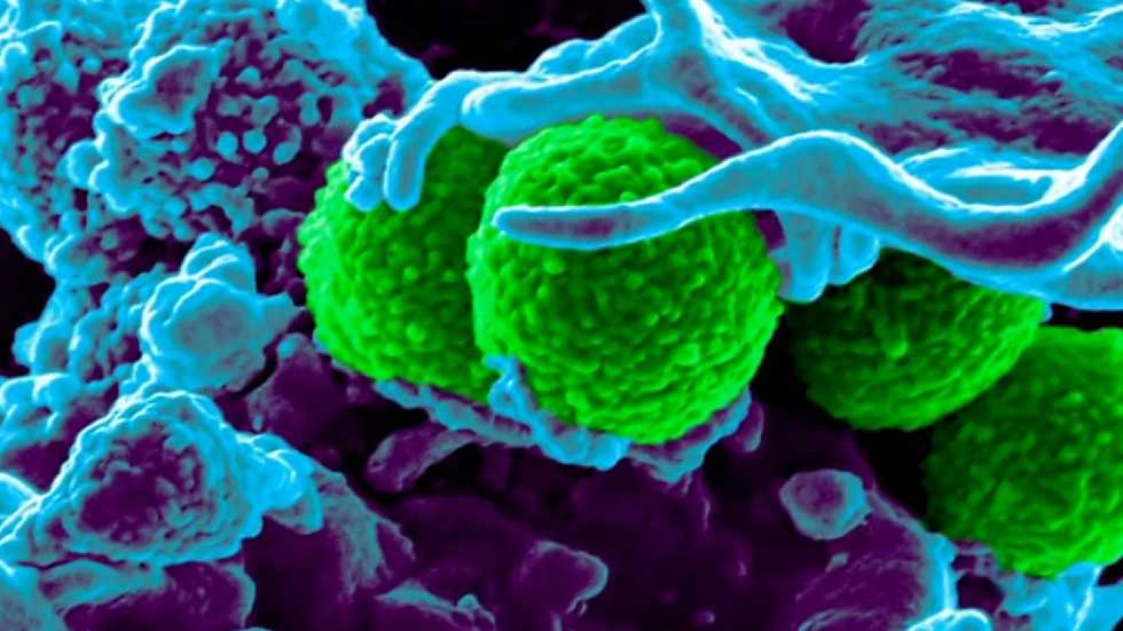 El escarabajo verde - La tormenta perfecta - ver ahora