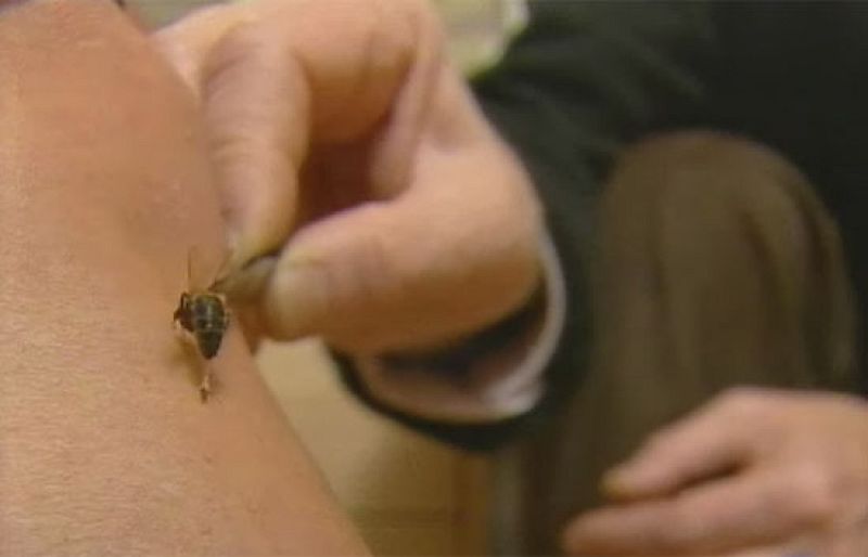El veneno de las abejas tiene propiedades curativas - Ciencia y tecnología en Rtve.es | Ver